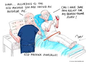 5-ECG-overcalls-Tau-Boga