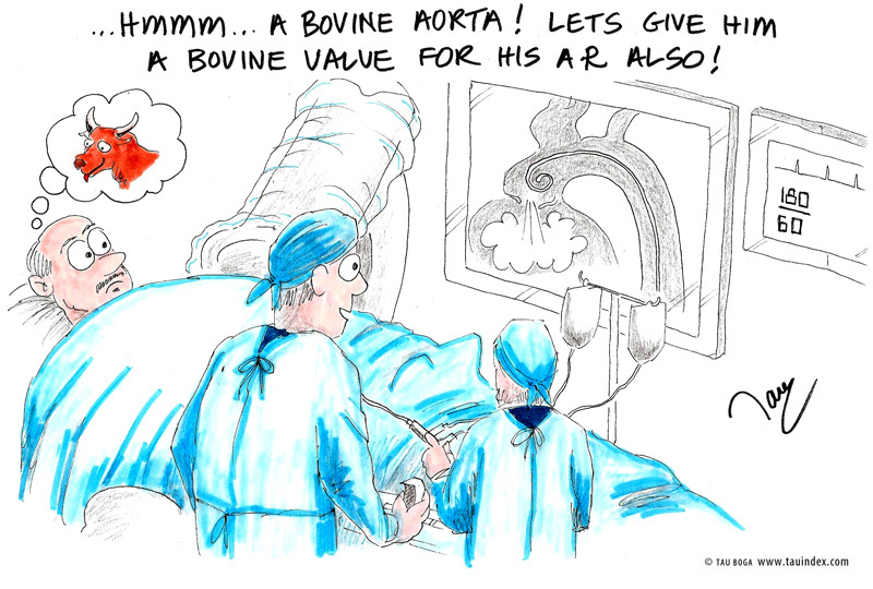5-cardio-bovine-aorta