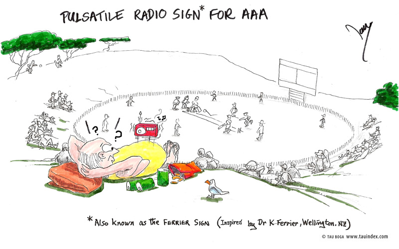 5-pulsatile-radio-s#350004